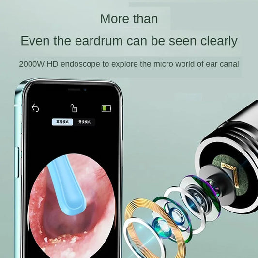 EarScope™ Visual Earpick (Wireless)