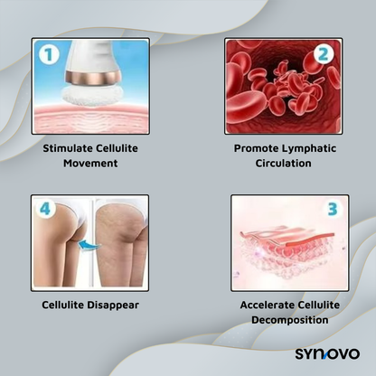 SlimSculpt™ Electric Cellulite & Fat Burner